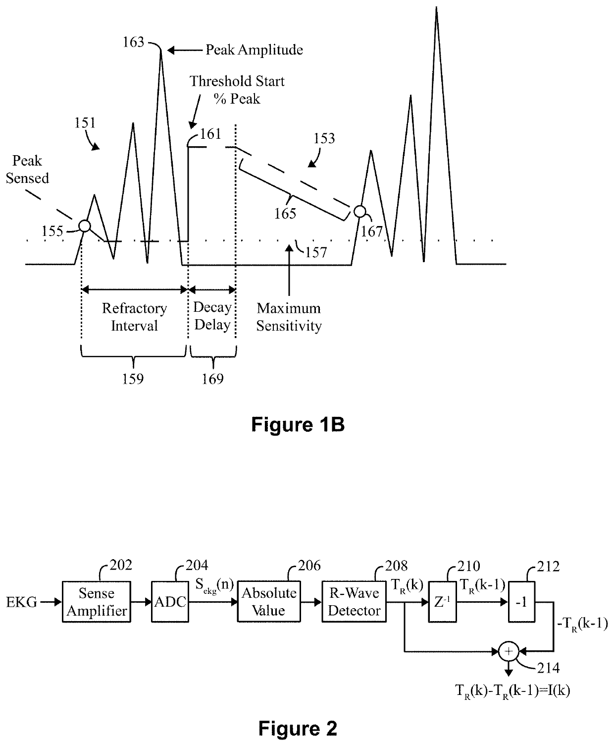 Method and system to detect r-waves in cardiac activity signals