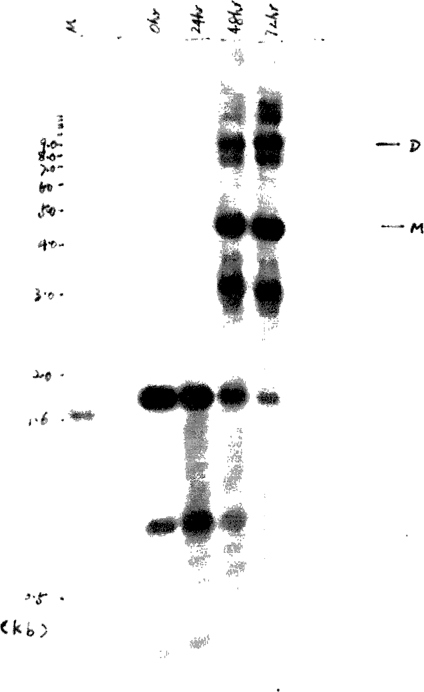 Human beta-globin gene and recombinant adeno related viral vector thereof