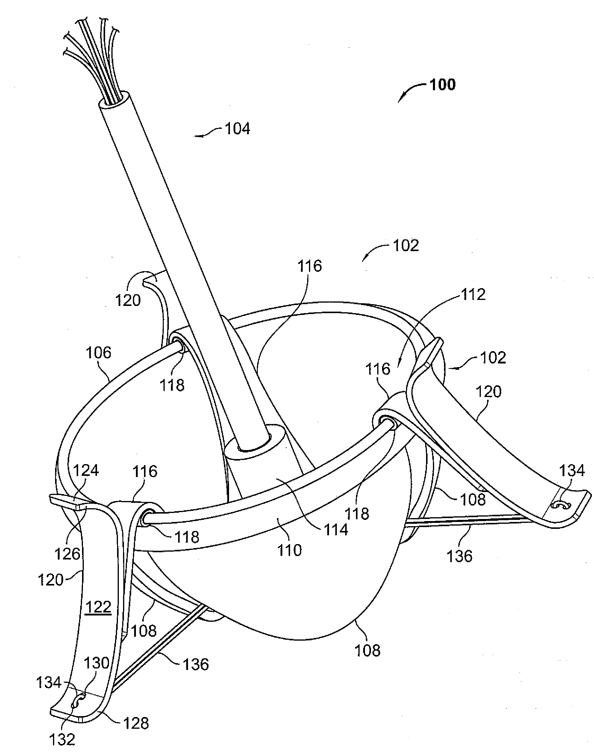 Mitral Valve System