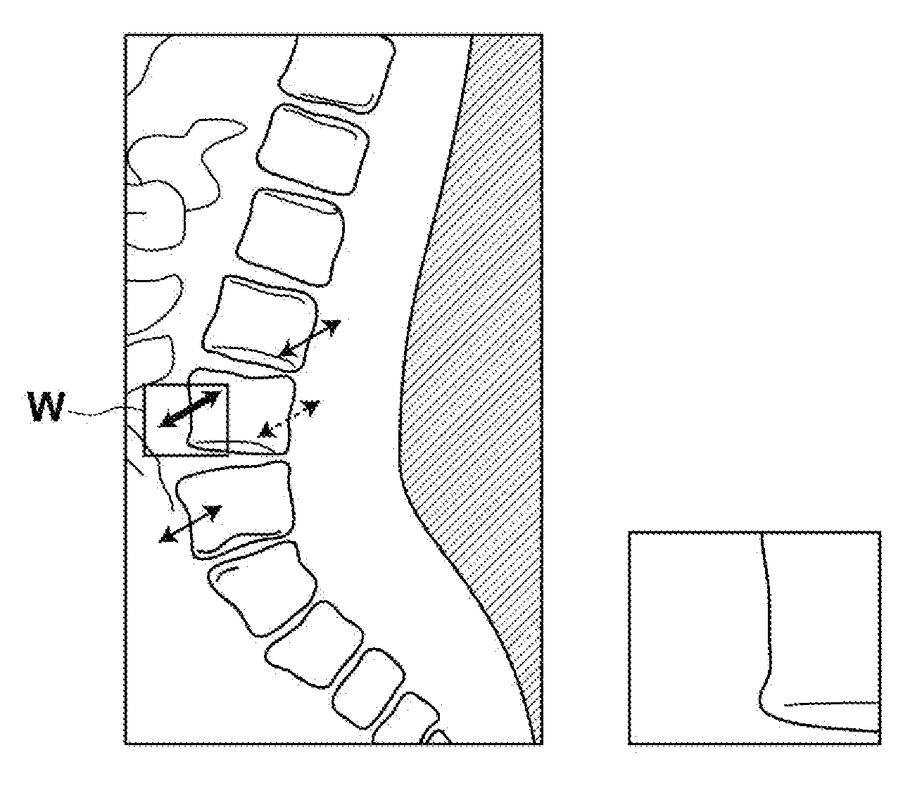 Body motion detection device and method