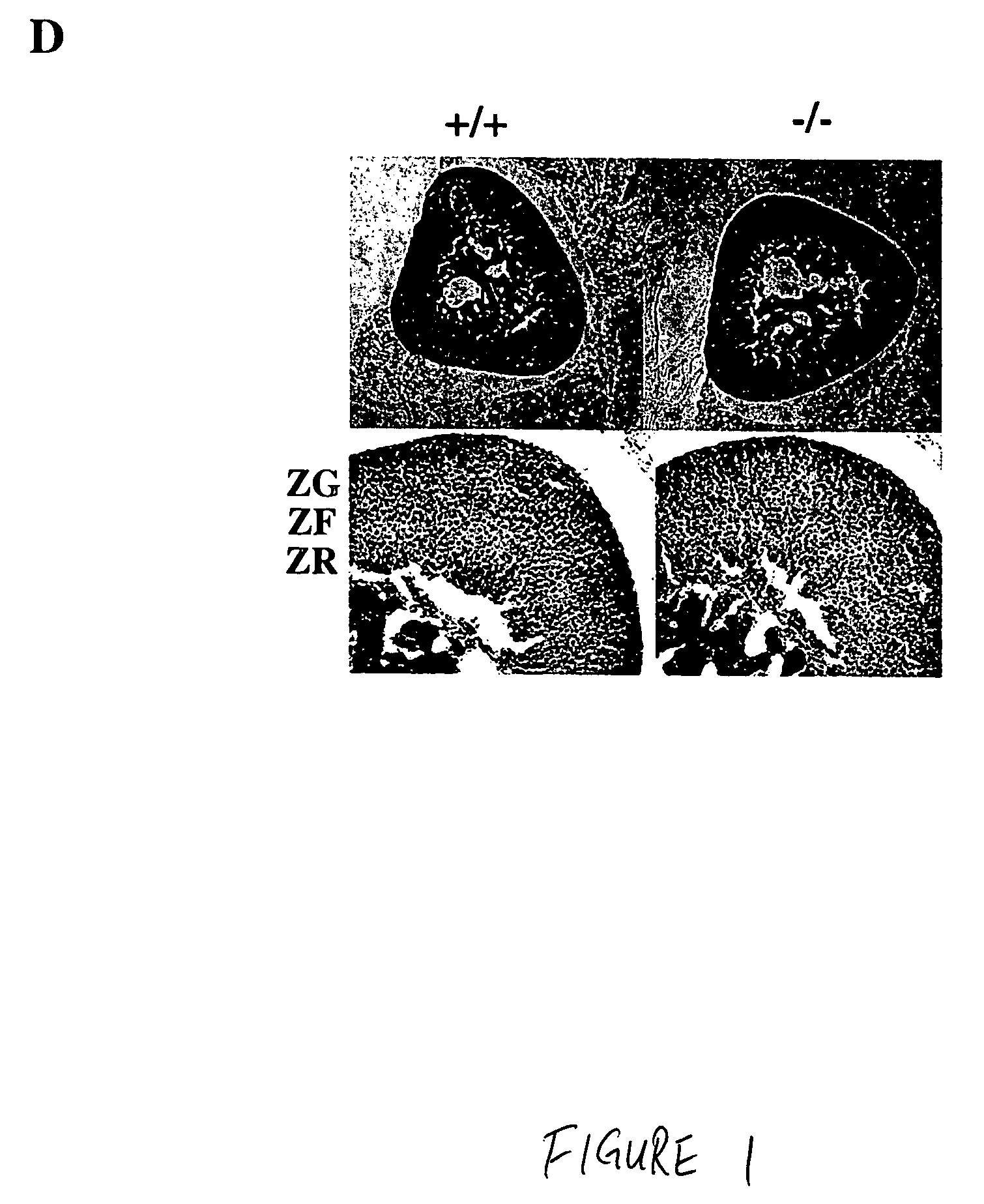 Method of inhibiting angiogenesis by administration of a corticotropin releasing factor receptor 2 agonist