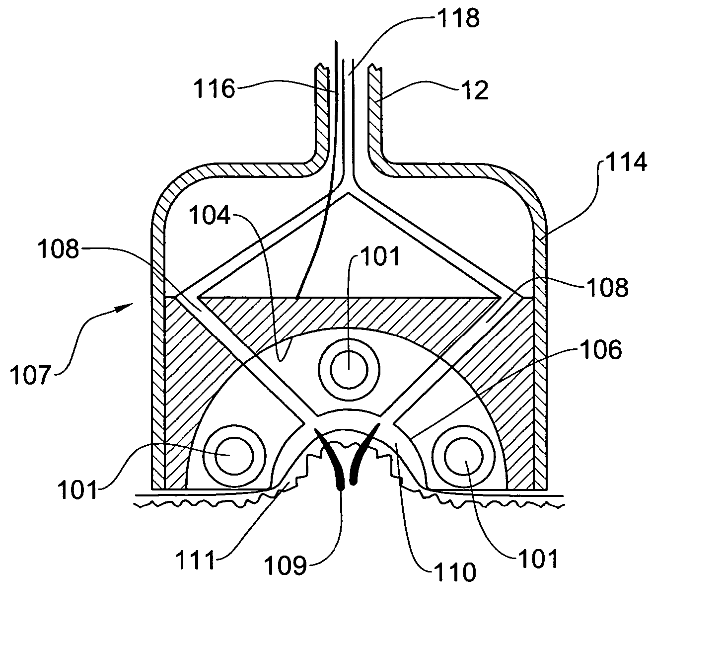 Method and system for skin treatment using light energy and skin deformation