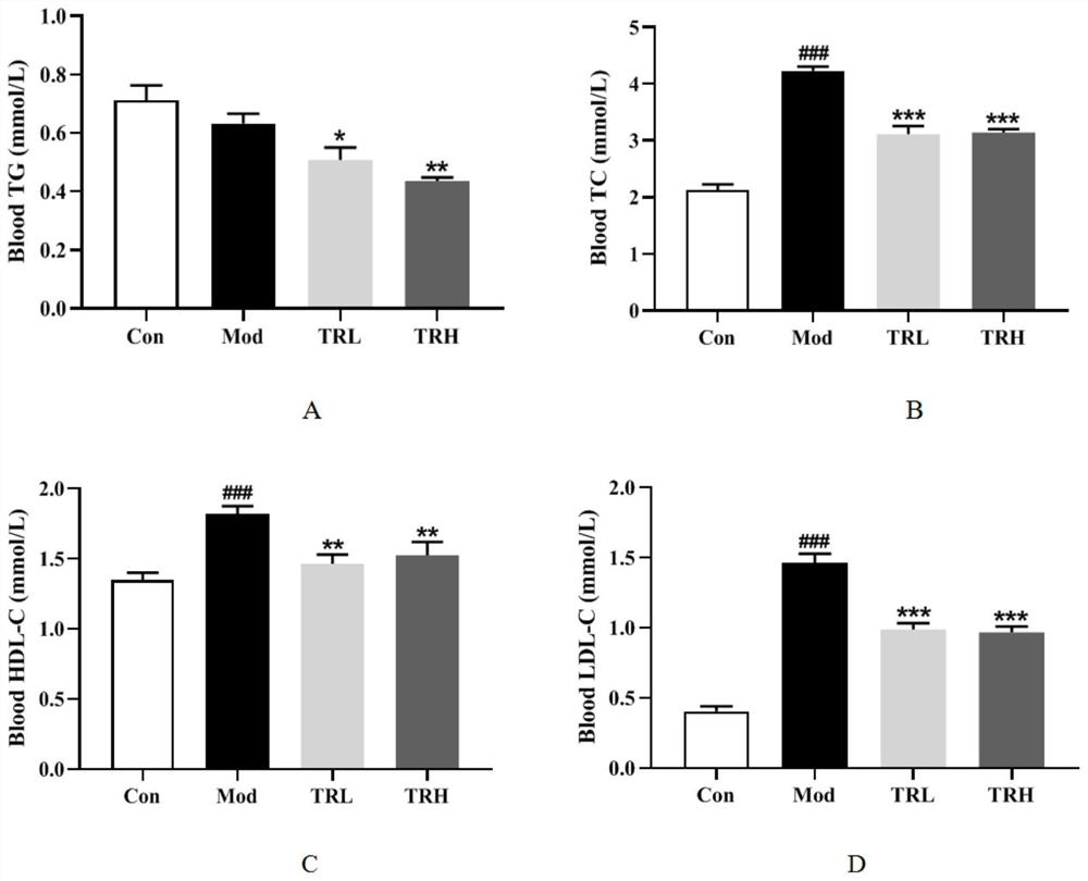 Application of trilobatin in preparation of medicine for preventing and/or treating non-alcoholic fatty liver disease