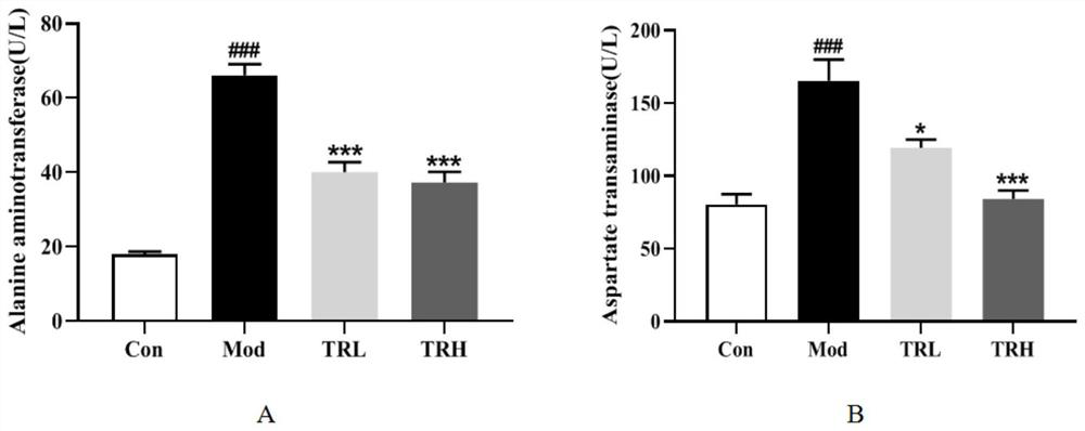 Application of trilobatin in preparation of medicine for preventing and/or treating non-alcoholic fatty liver disease