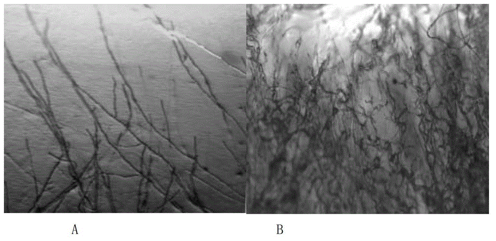 Bacillus subtilis and application thereof