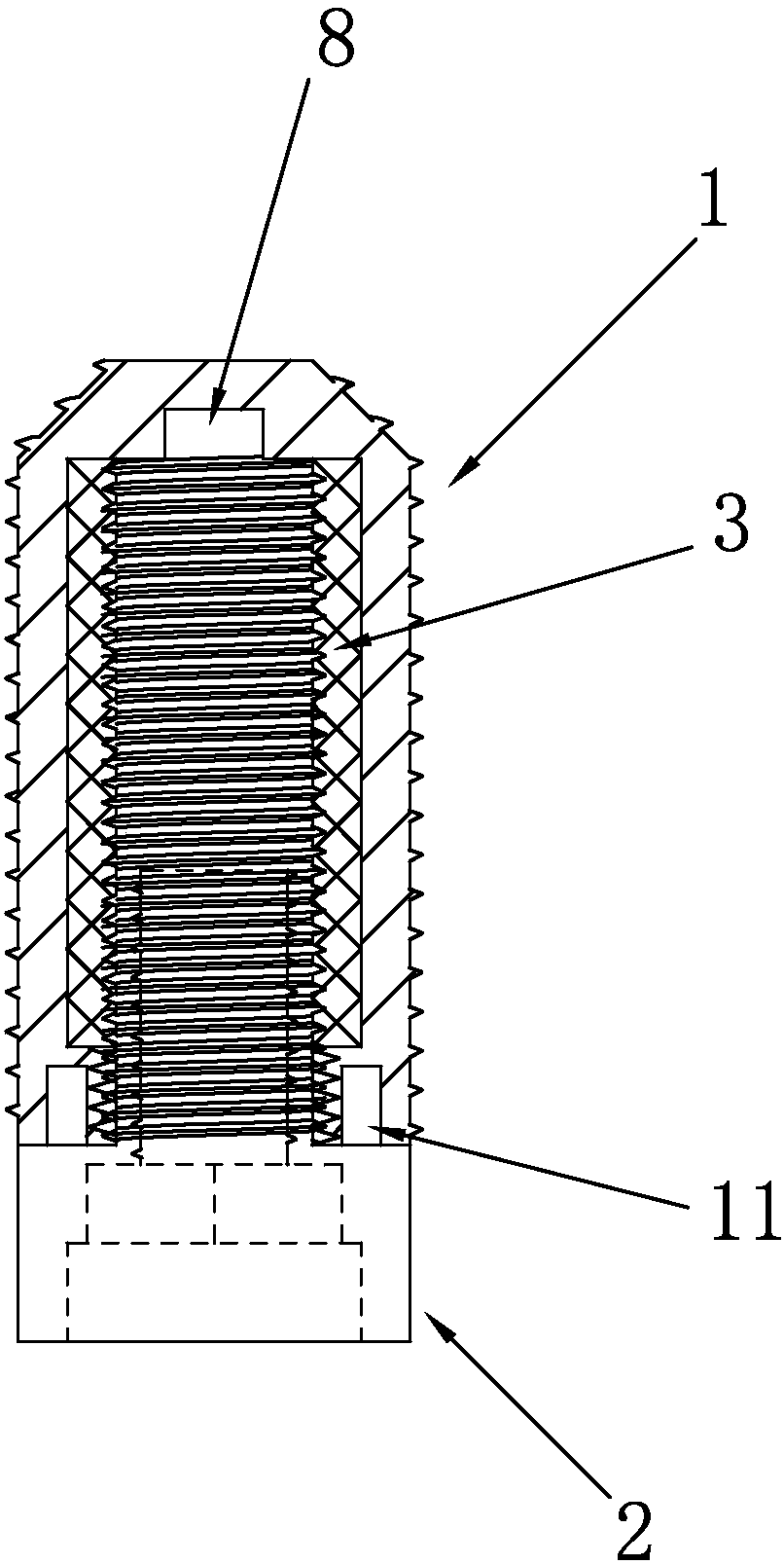 Dental implant containing polyether-ether-ketone interlayer and manufacturing method thereof