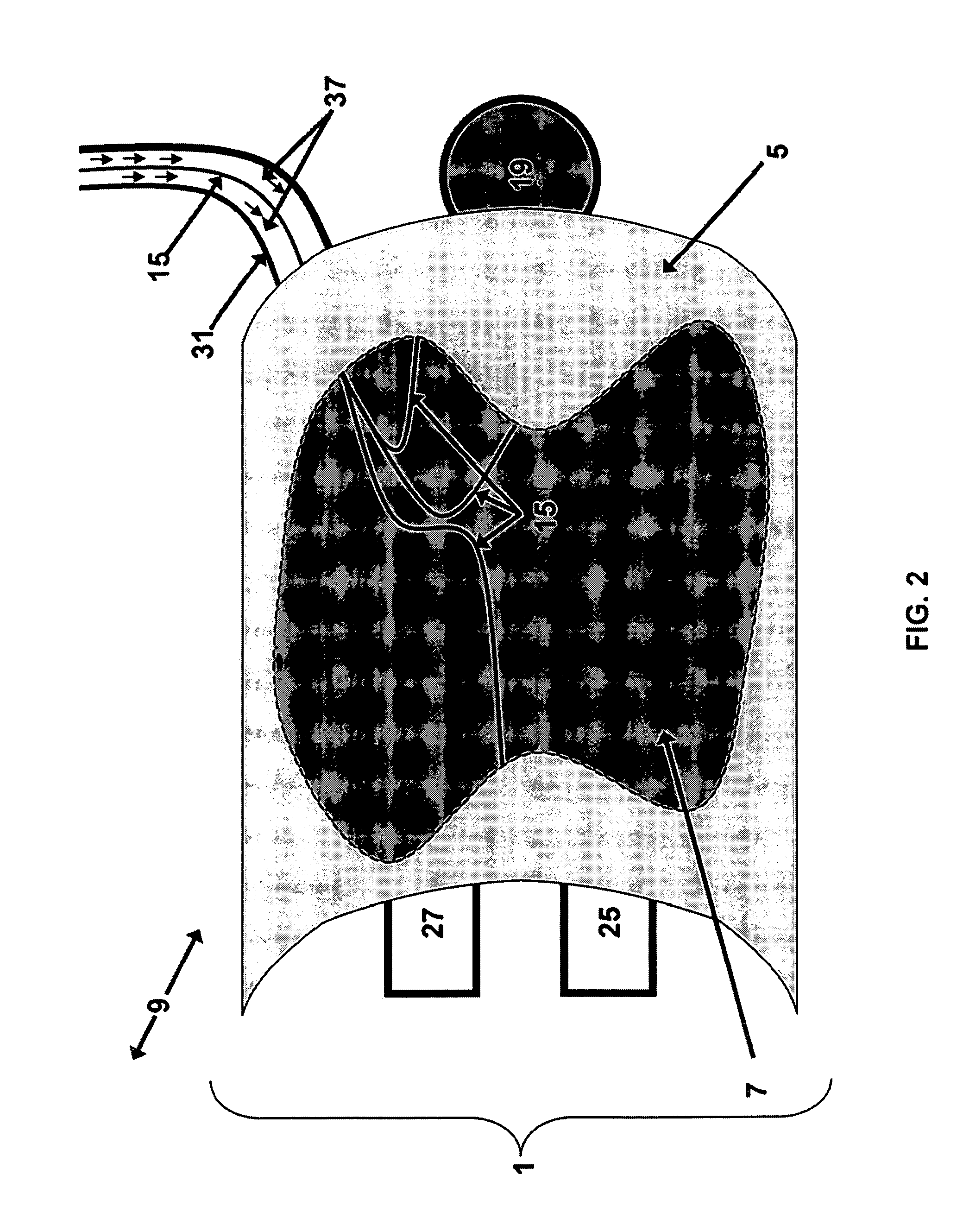 Explosion proof vehicle for tank inspection