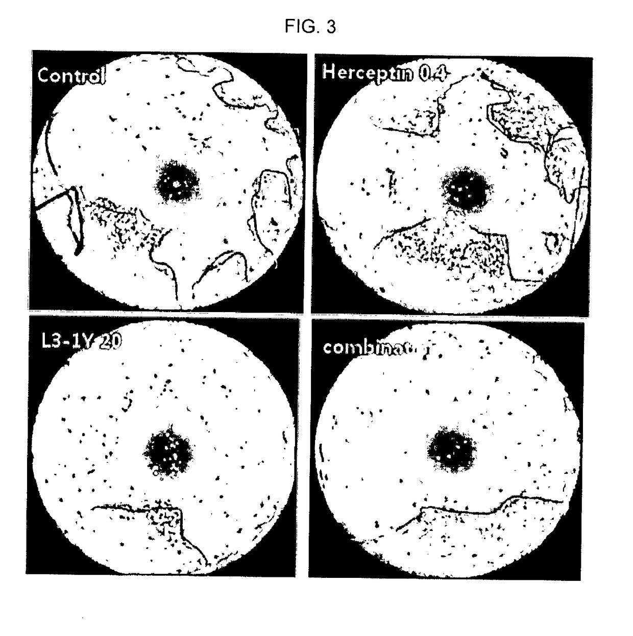 Composition for combination therapy comprising Anti-her2 antibody and Anti-c-met antibody