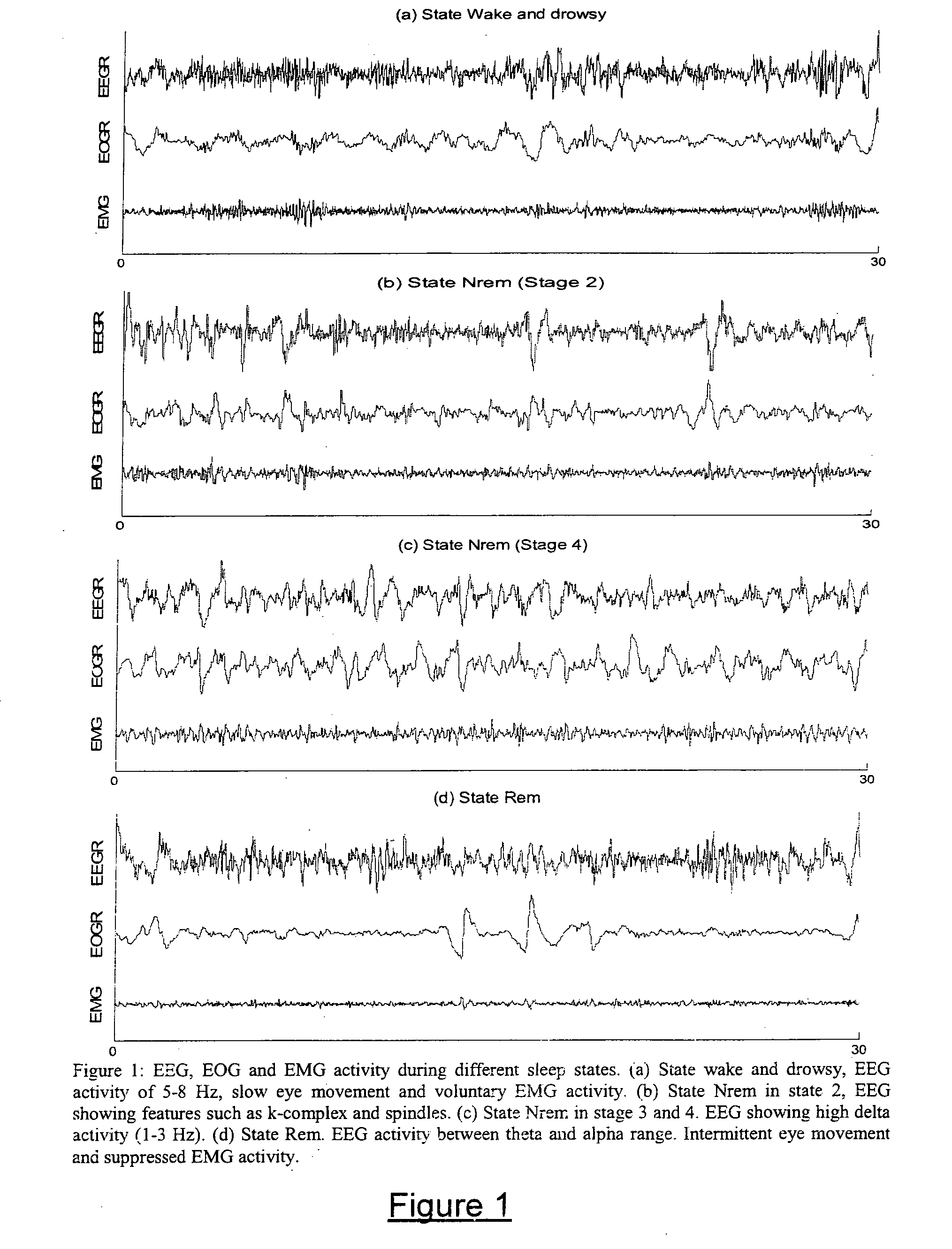 Method and apparatus for determining sleep states