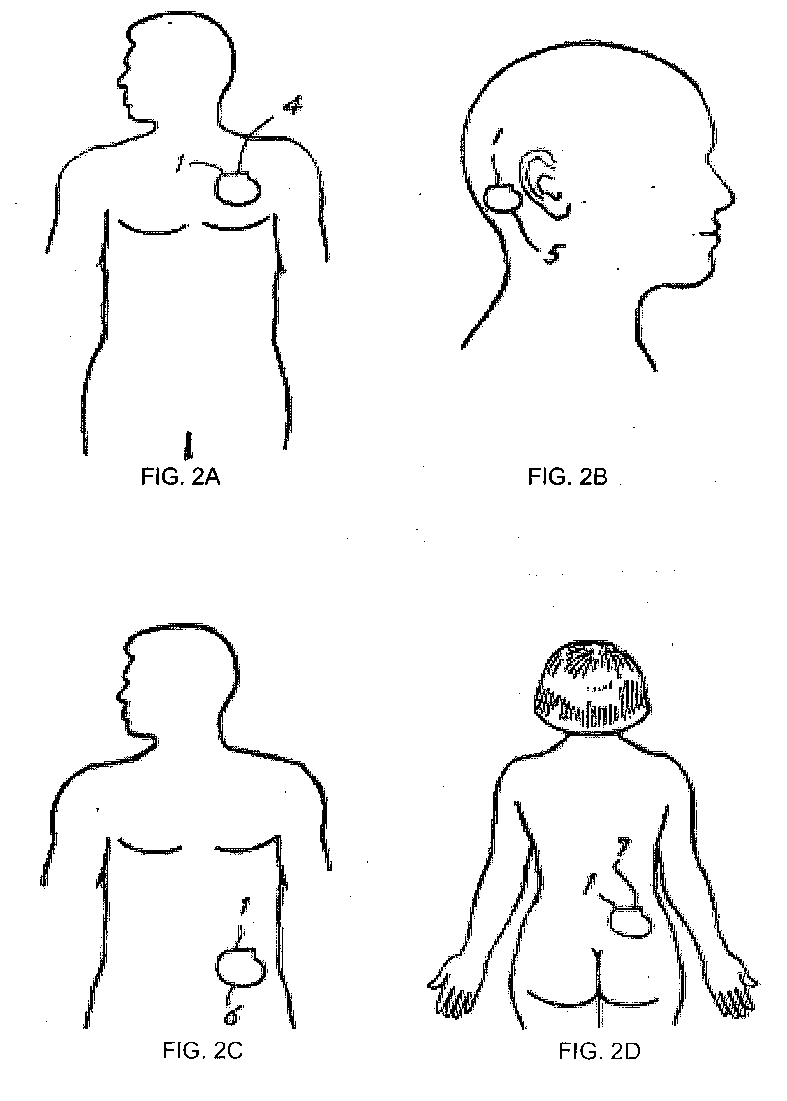 Amplitude ramping of waveforms generated by an implantable medical device