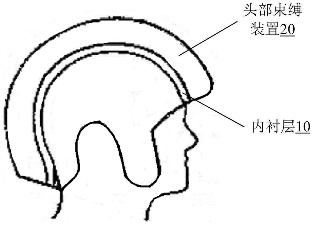 Skull orthopedic device and manufacturing method thereof