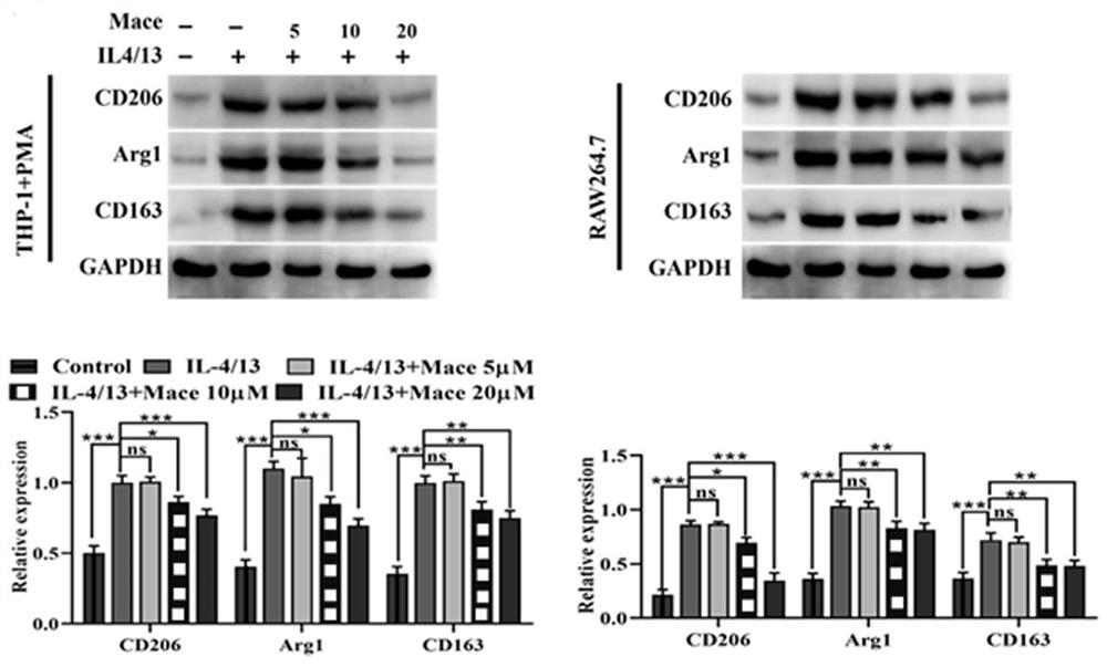 Application of anwuligan or pharmaceutical composition thereof in colorectal cancer treatment