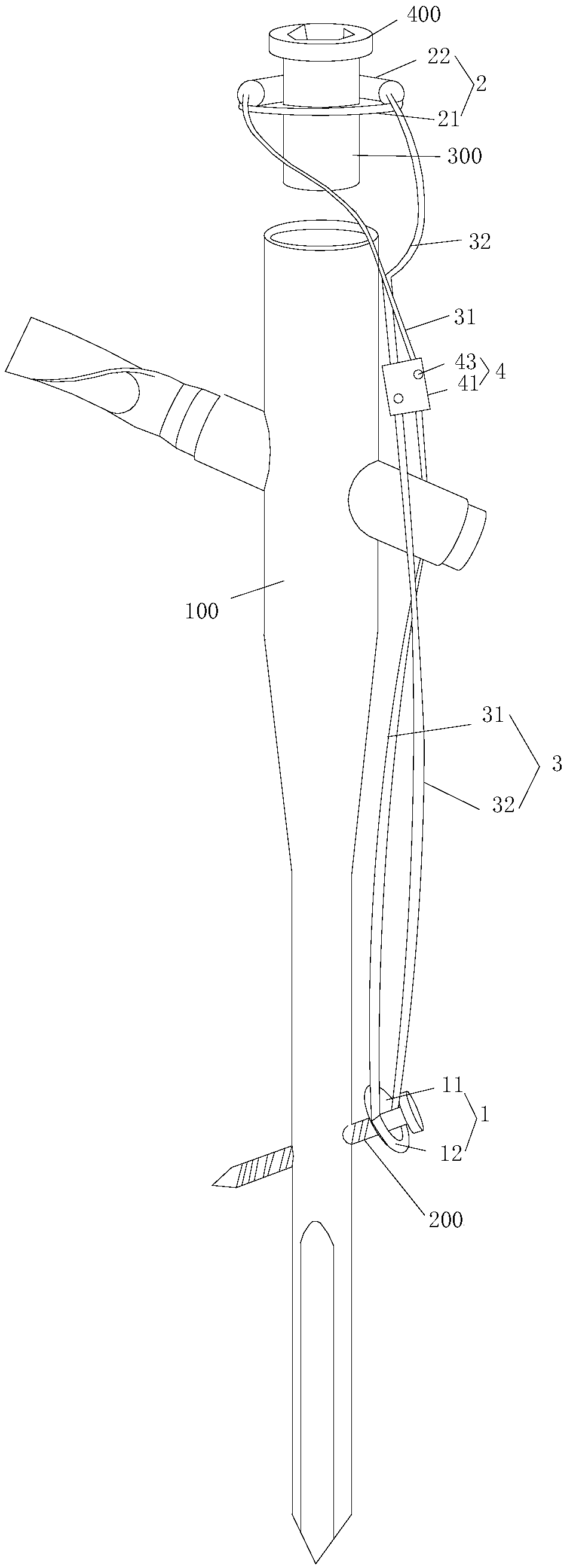 Tension band system matched with proximal femoral nail