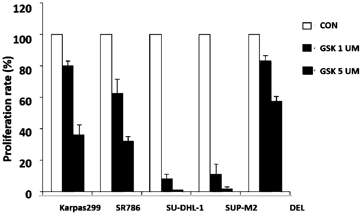 Application of GSK1838705a in ALK + ALCL and crizotinib-resistant ALK + ALCL