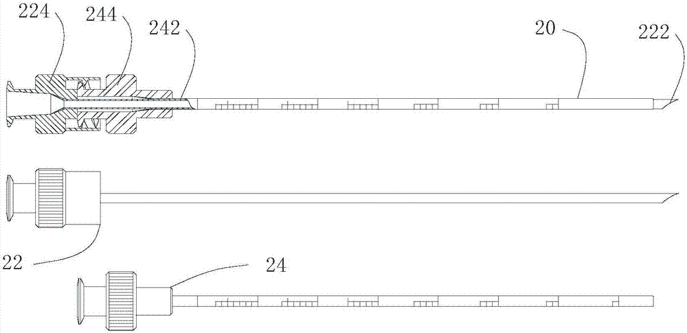 Trigeminal gasserian ganglion compression device