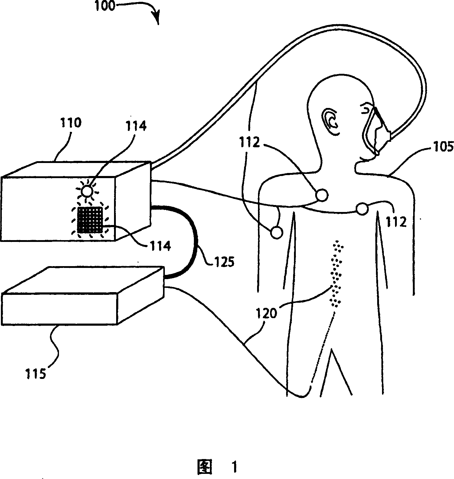 System and method of modular integration of intravascular gas exchange catheter with respiratory monitor and ventilator