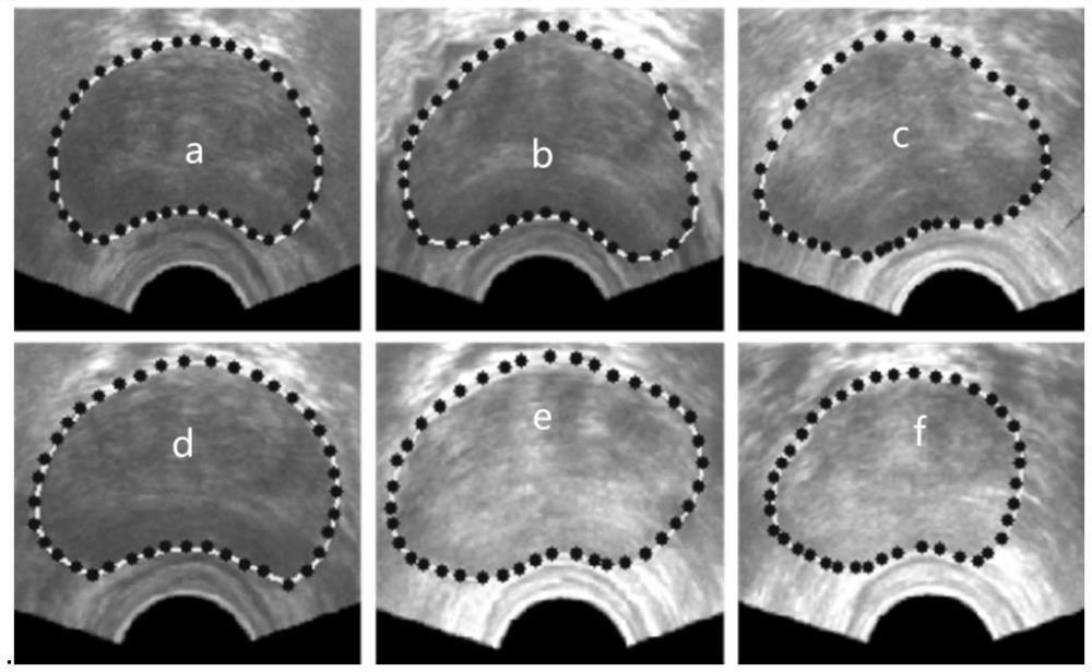 Prostate activity appearance model establishment method based on TURS image