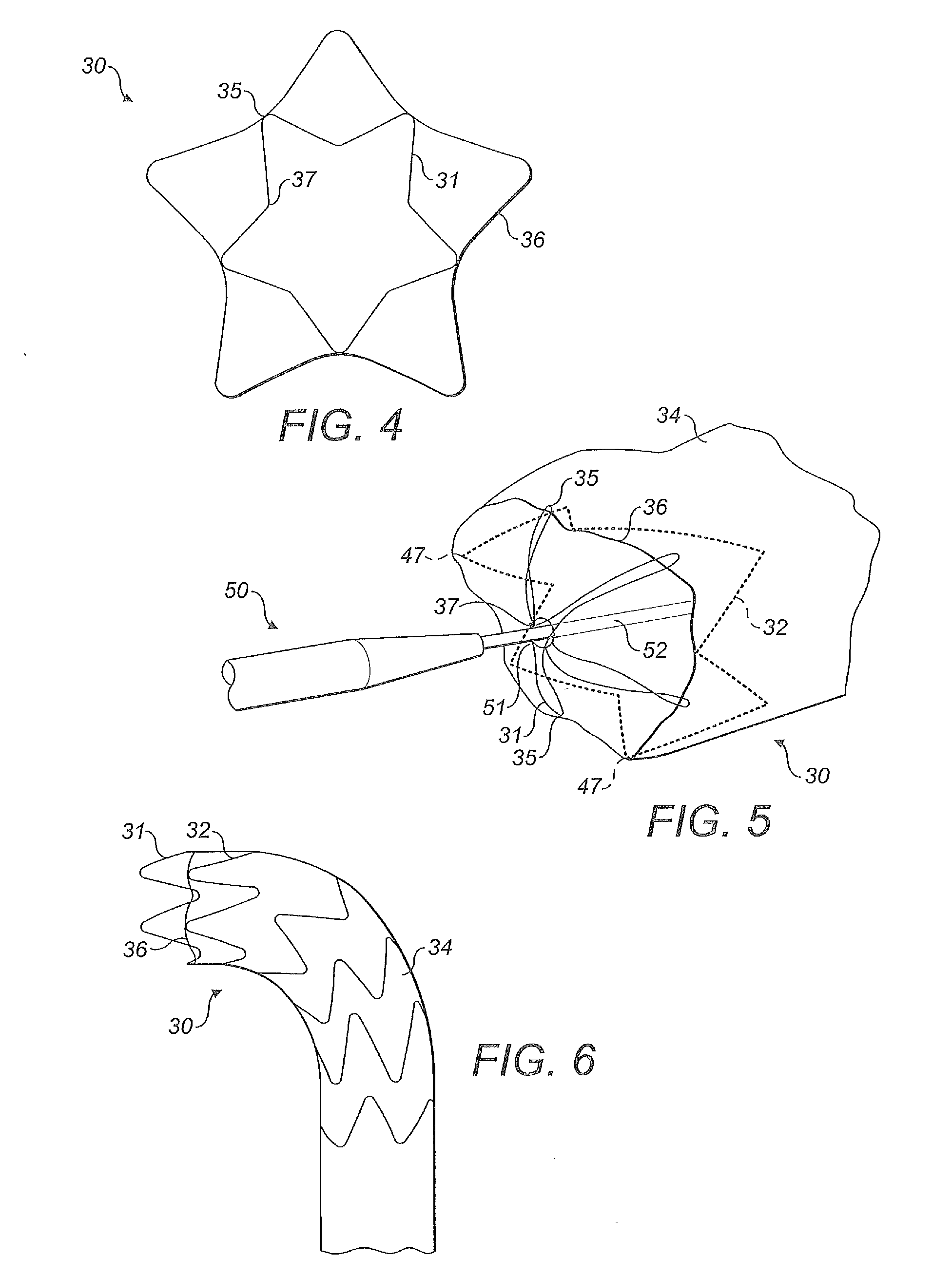 Stent graft