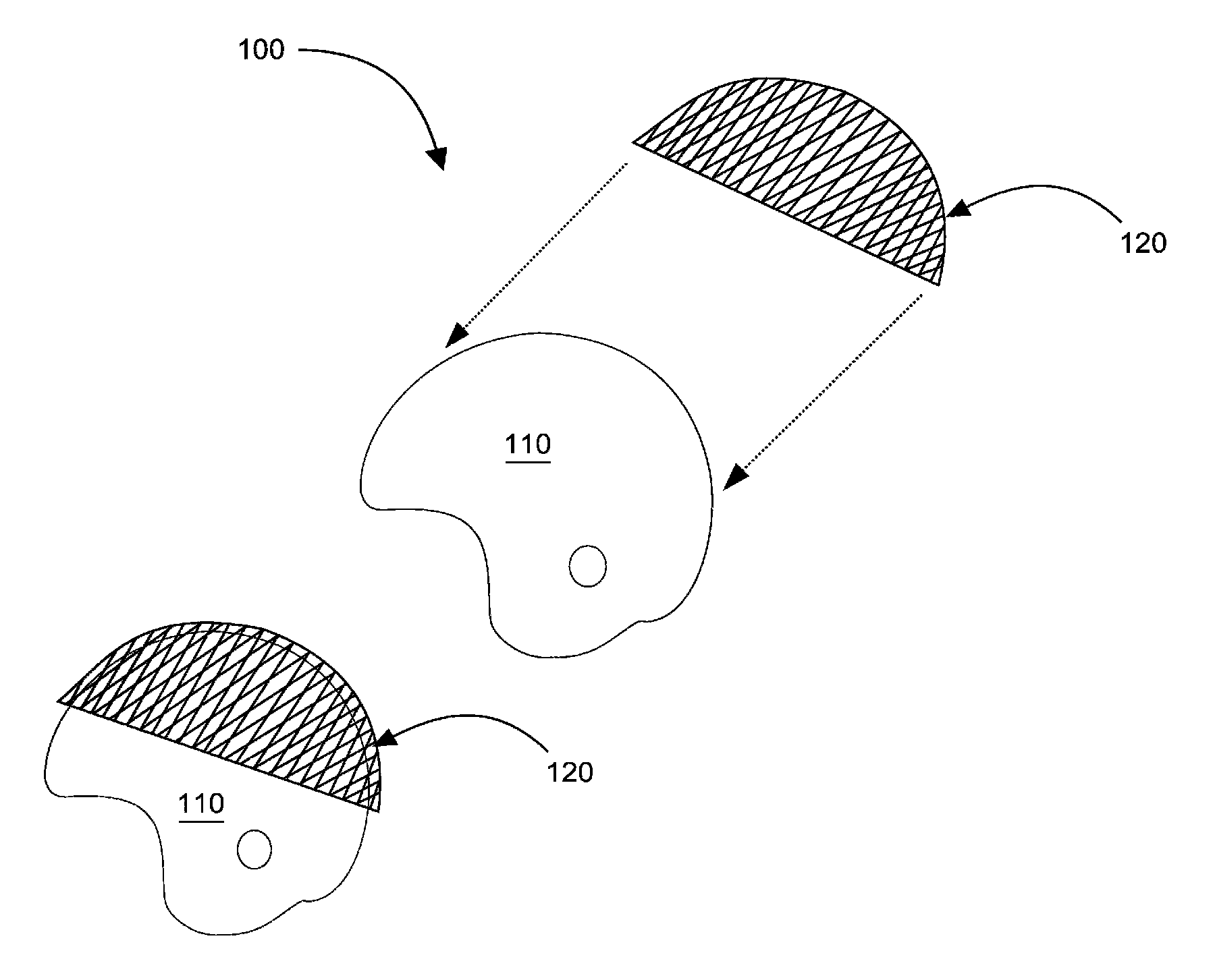 Helmet pro system