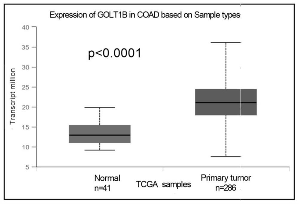 Application of GOLT1B inhibitor in preparation of medicine for treating colorectal cancer