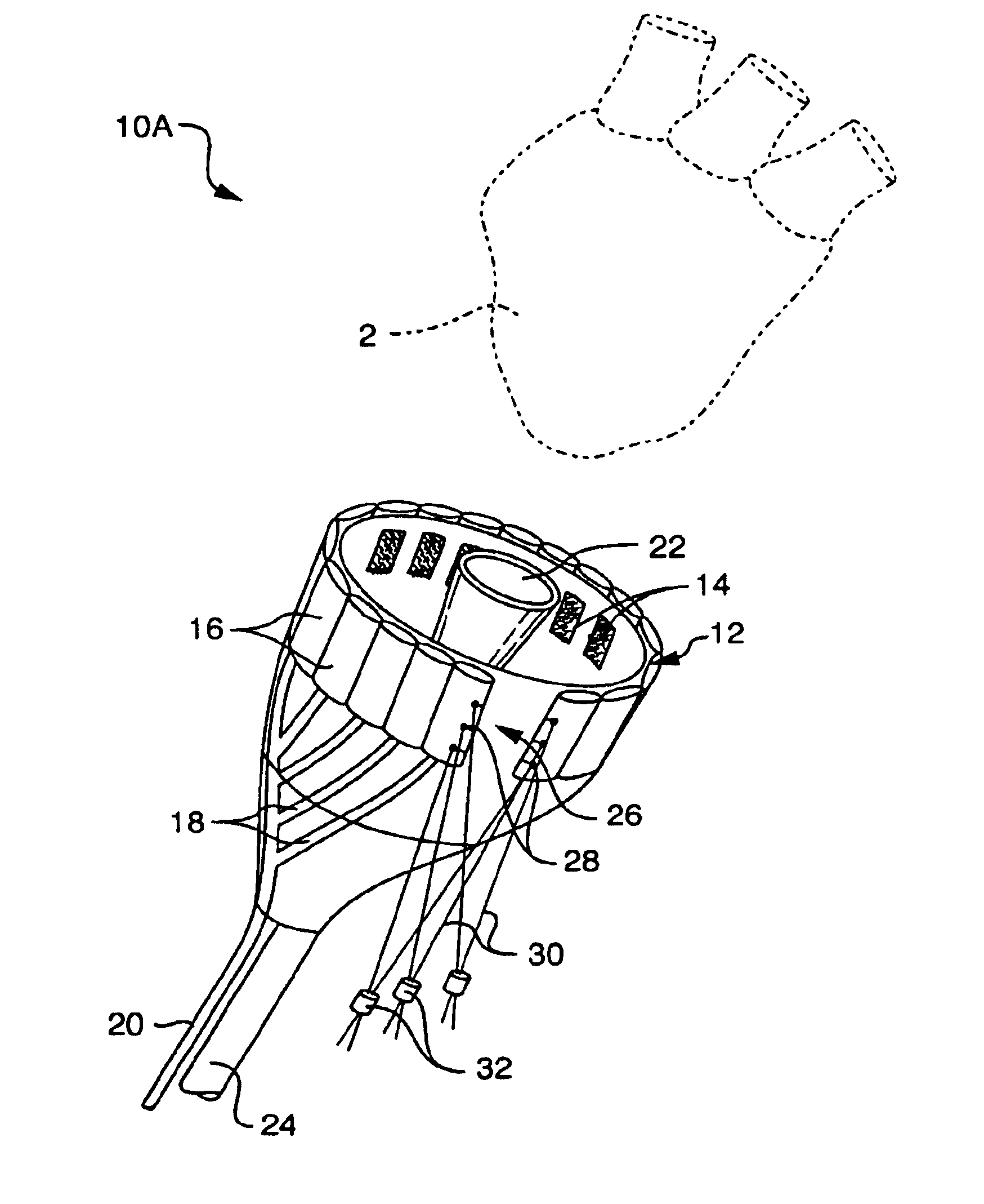 Apparatus and method for detachably securing a device to a natural heart