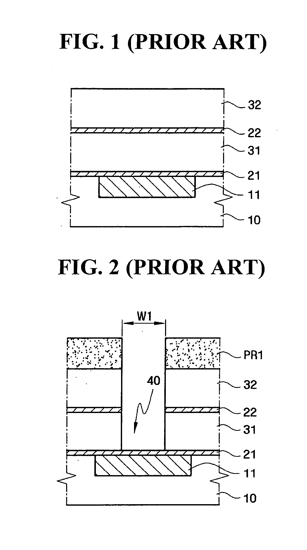 Method of forming metal interconnect of semiconductor device