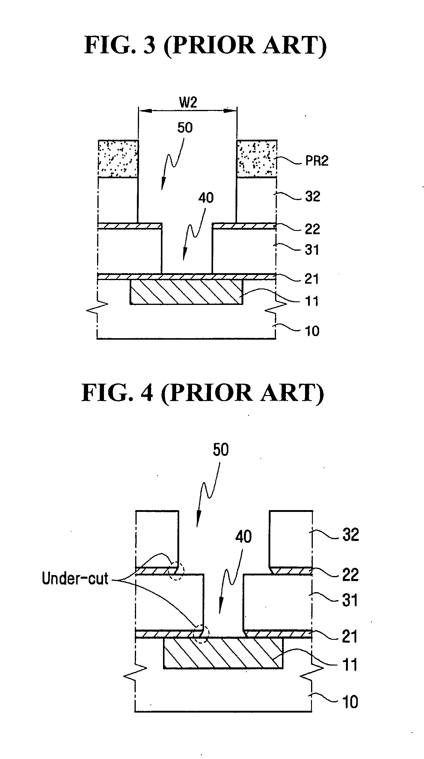 Method of forming metal interconnect of semiconductor device