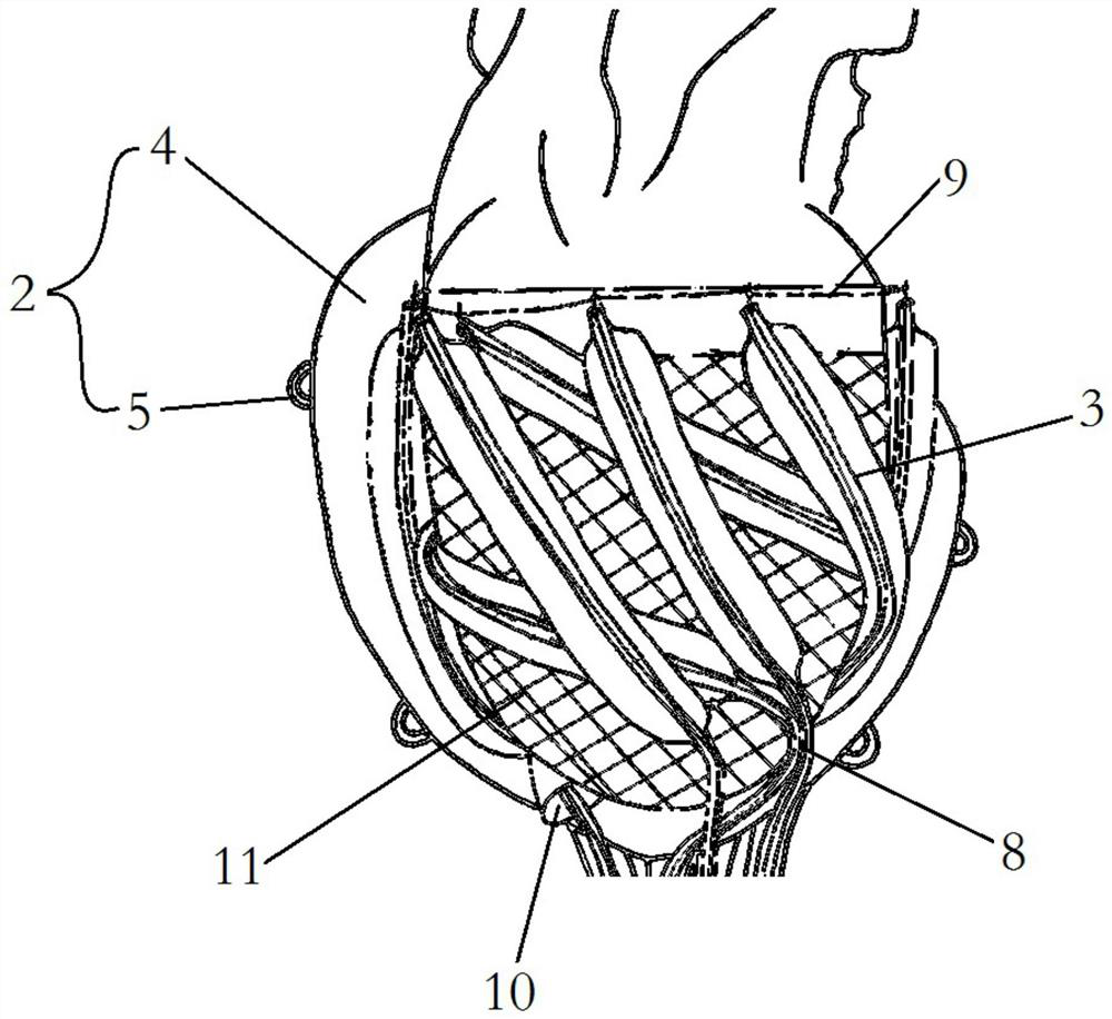 Power pump type artificial intelligence heart