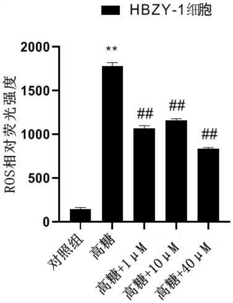 Ferulic acid derivative as well as preparation method and application thereof