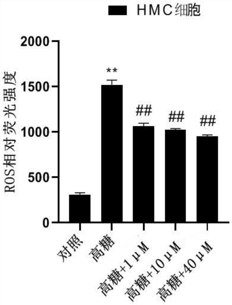 Ferulic acid derivative as well as preparation method and application thereof