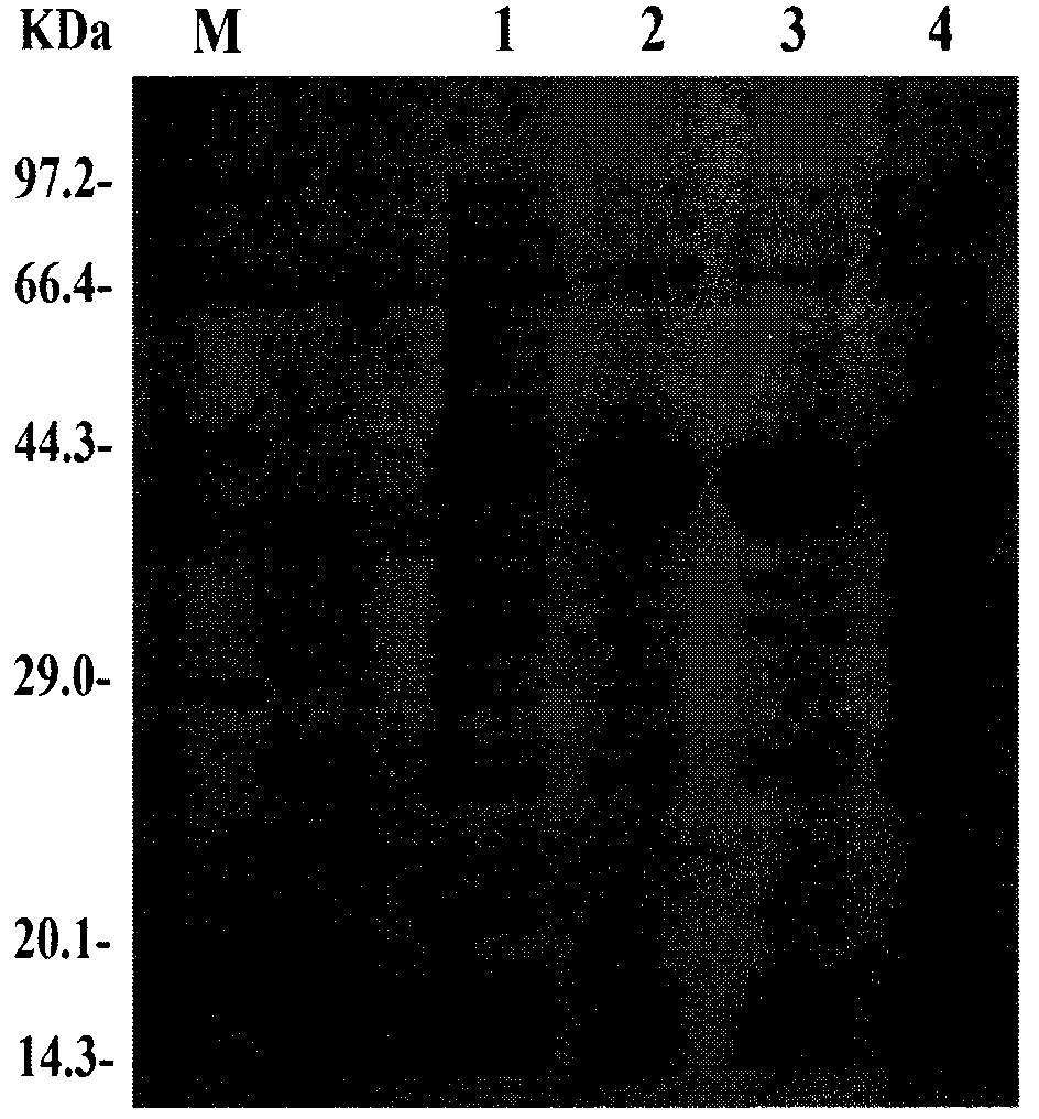 Pronucleus expression of epoxide hydrolase gene (EH-B) and preparation of chiral epichlorohydrin