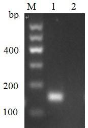 Real-time fluorescent PCR detection kit for Nosema bumblebee and detection method thereof