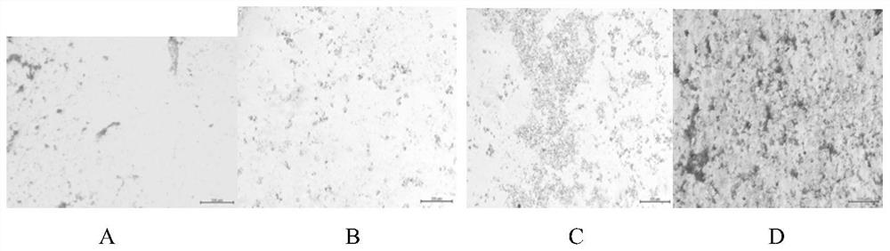 Method for preparing bone filling material by doping lithium citrate into hydroxyapatite nanoparticles