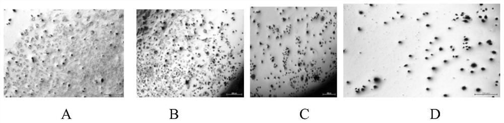 Method for preparing bone filling material by doping lithium citrate into hydroxyapatite nanoparticles