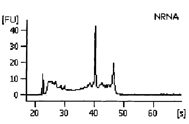 Method for extracting extracellular RNA from seminal plasma