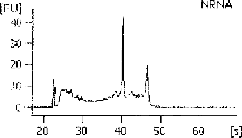 Method for extracting extracellular RNA from seminal plasma