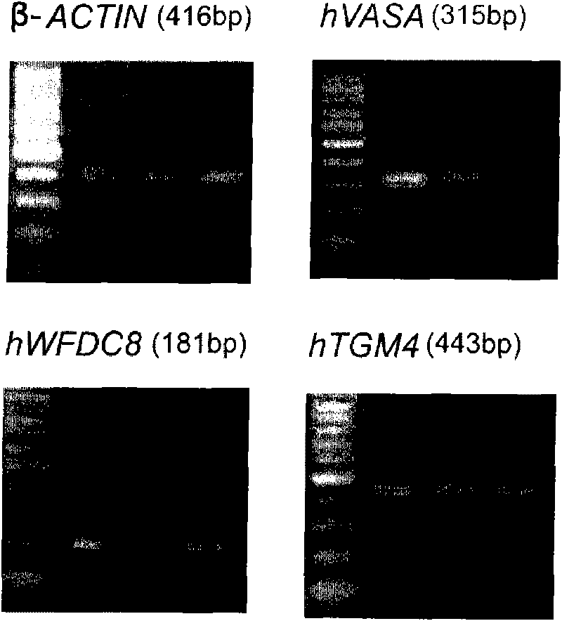 Method for extracting extracellular RNA from seminal plasma