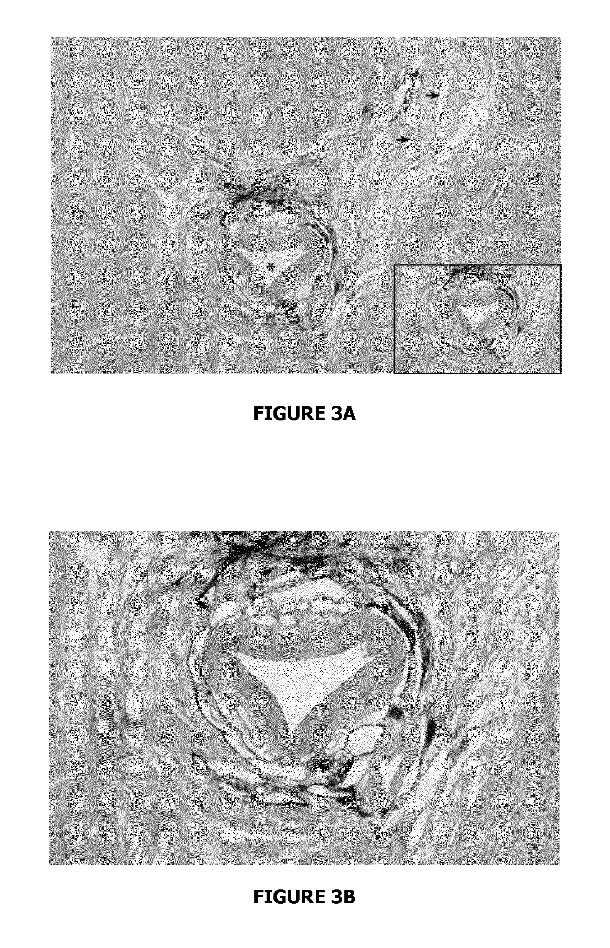 Compounds for use in methods for treating glaucoma and retinal diseases