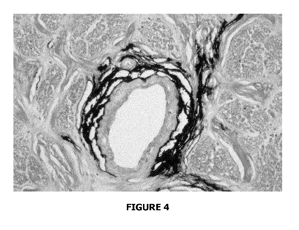 Compounds for use in methods for treating glaucoma and retinal diseases