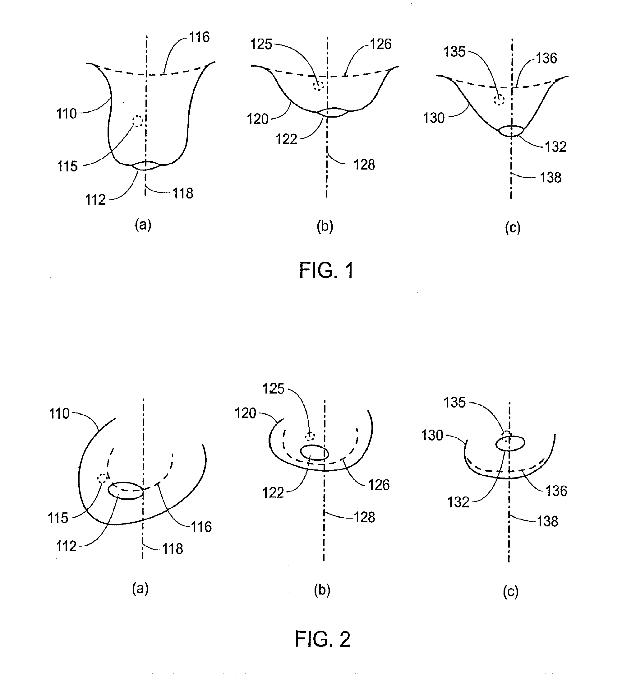 System and method for providing registration between breast shapes before and during surgery