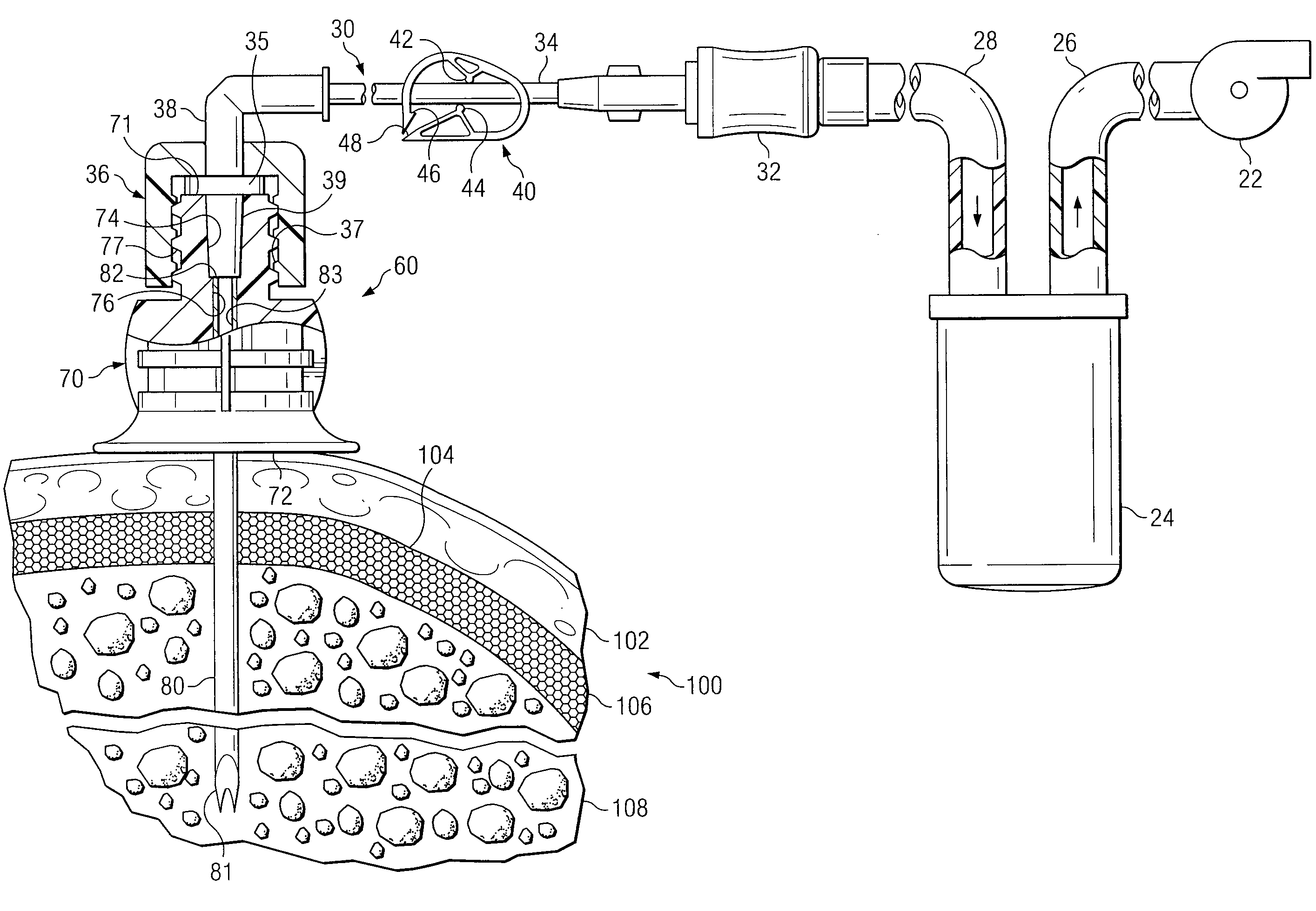 Apparatus and Methods to Harvest Bone and Bone Marrow