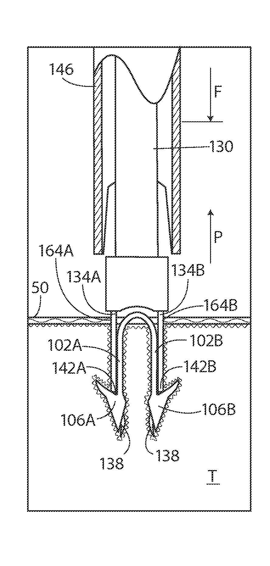 Methods and apparatus for delivering staples to a target tissue