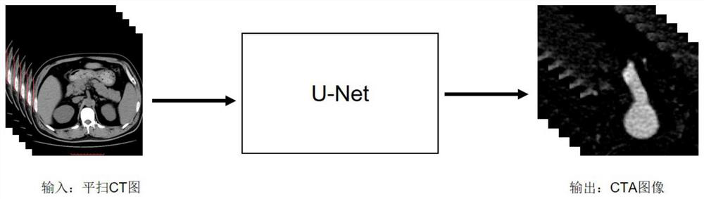 Method for generating CT angiography based on plain-scan CT