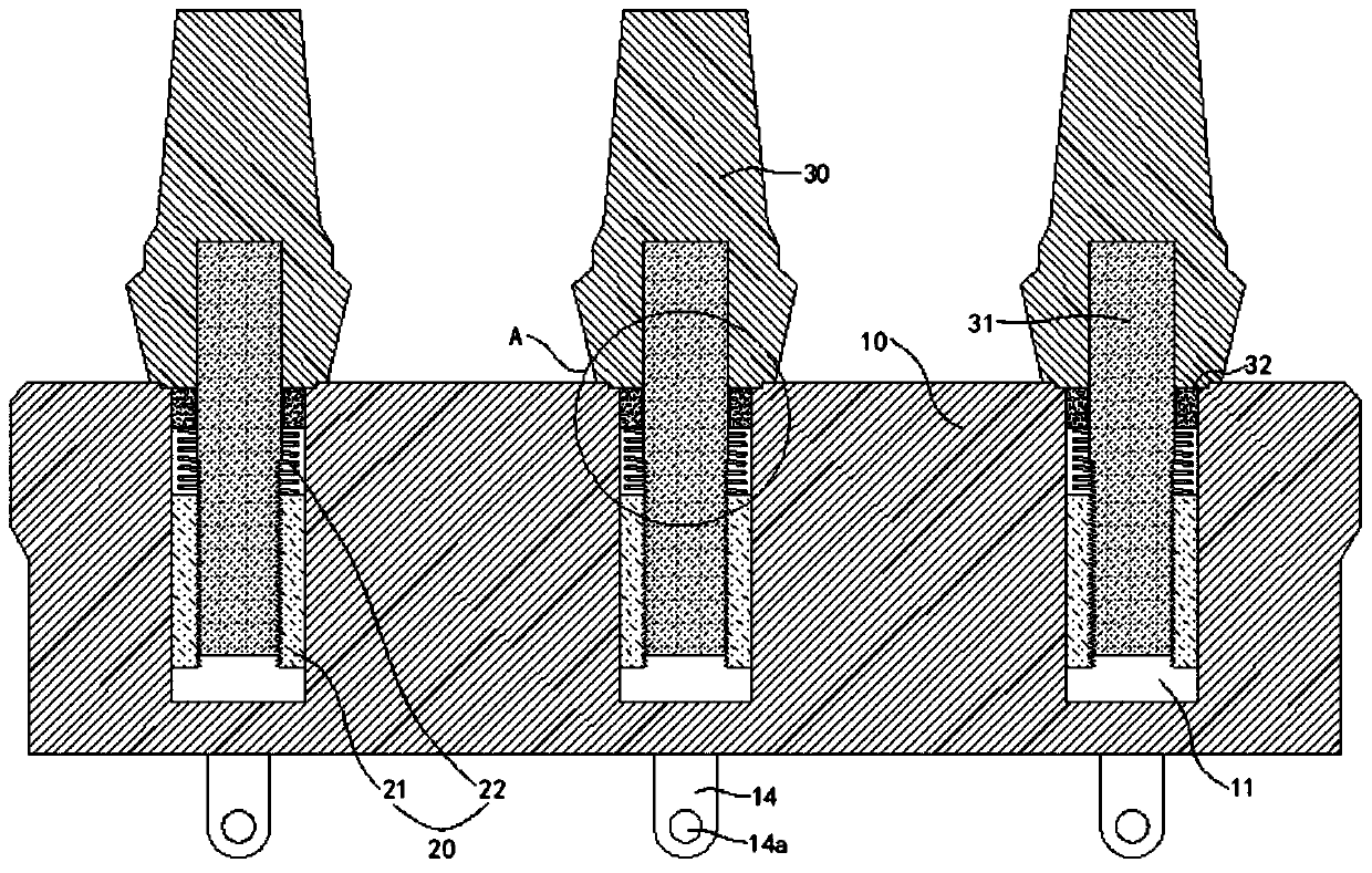 Dental implant structure, assembly method thereof and dental implant system