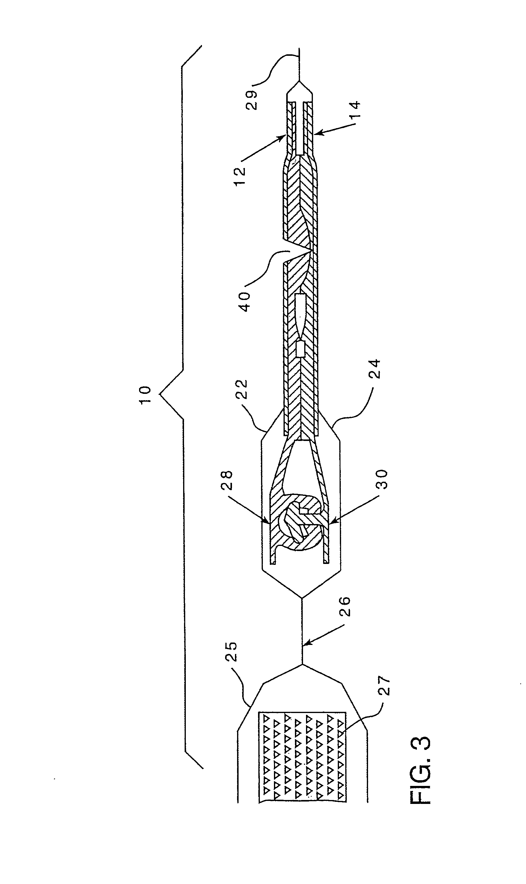 Closure arrangement with tear guide for allowing access to zipper flanges in a package