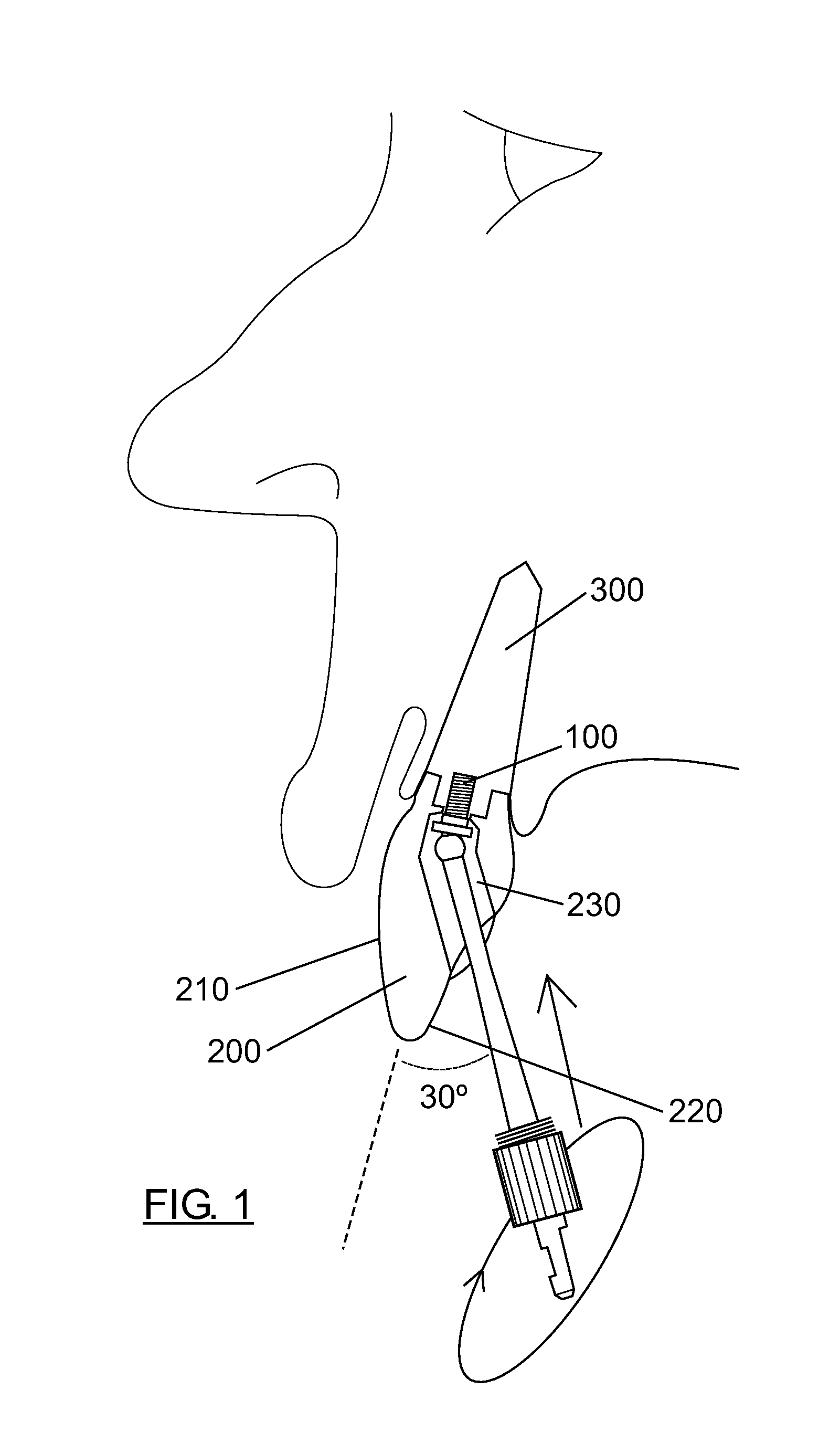 Screw to fix a prosthesis on a dental implant, surgical driver, kit and torque key (as amended)