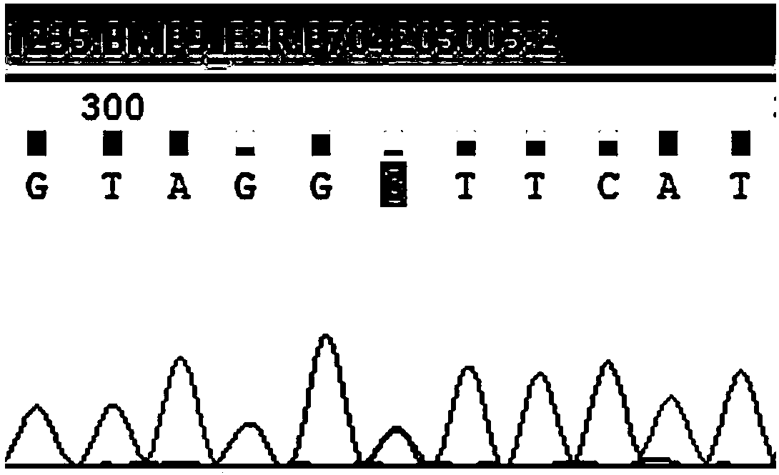 Pulmonary arterial hypertension associated mutant BMP9 gene and application thereof