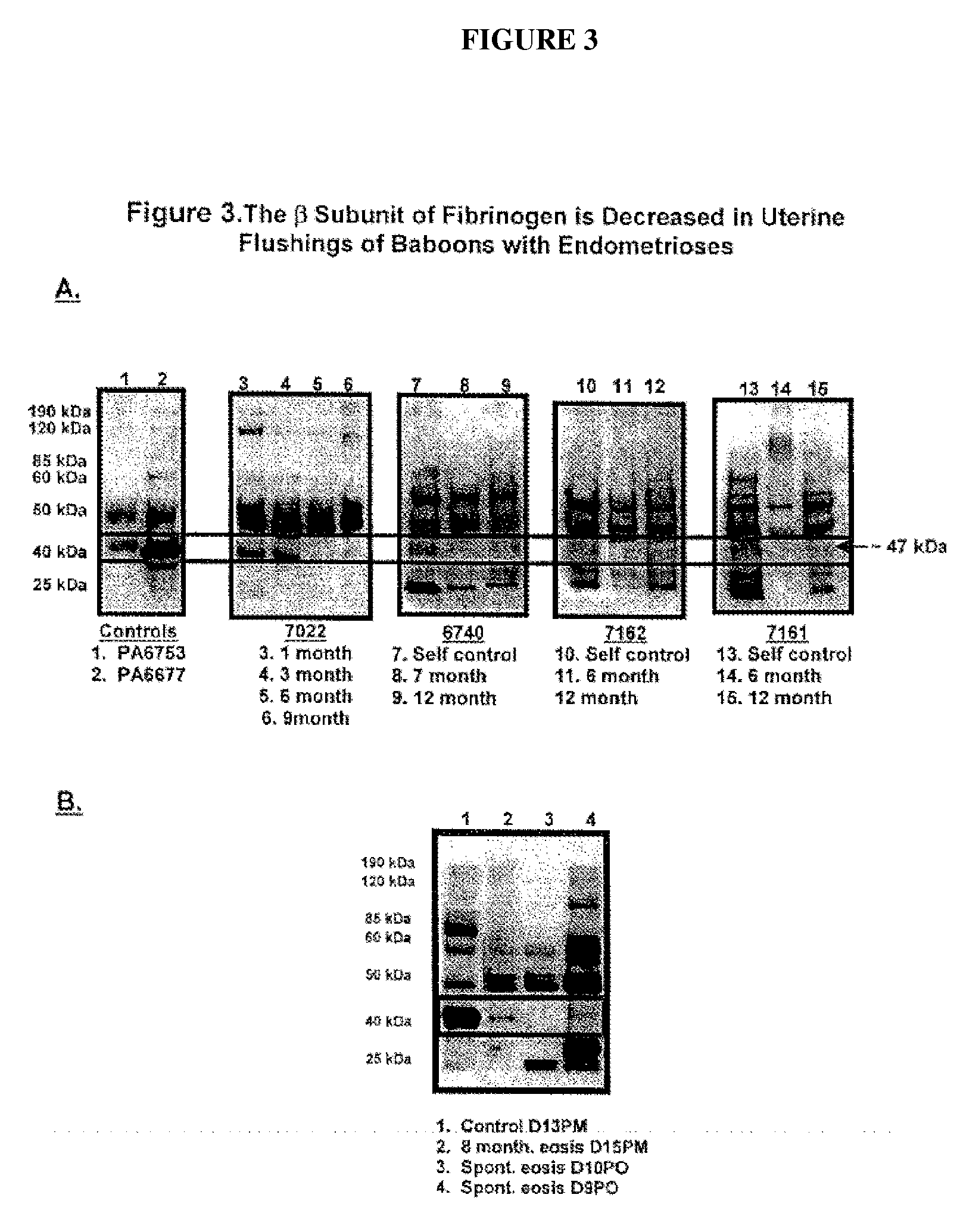 Methods for diagnosing endometriosis