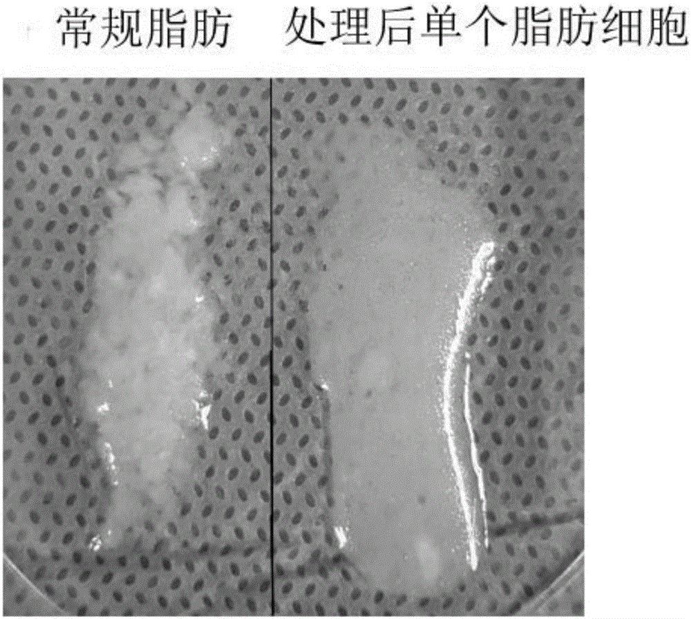 Processing method of adipose tissue, mesenchymal stem cell, single processed adipose cell, and extracellular matrix