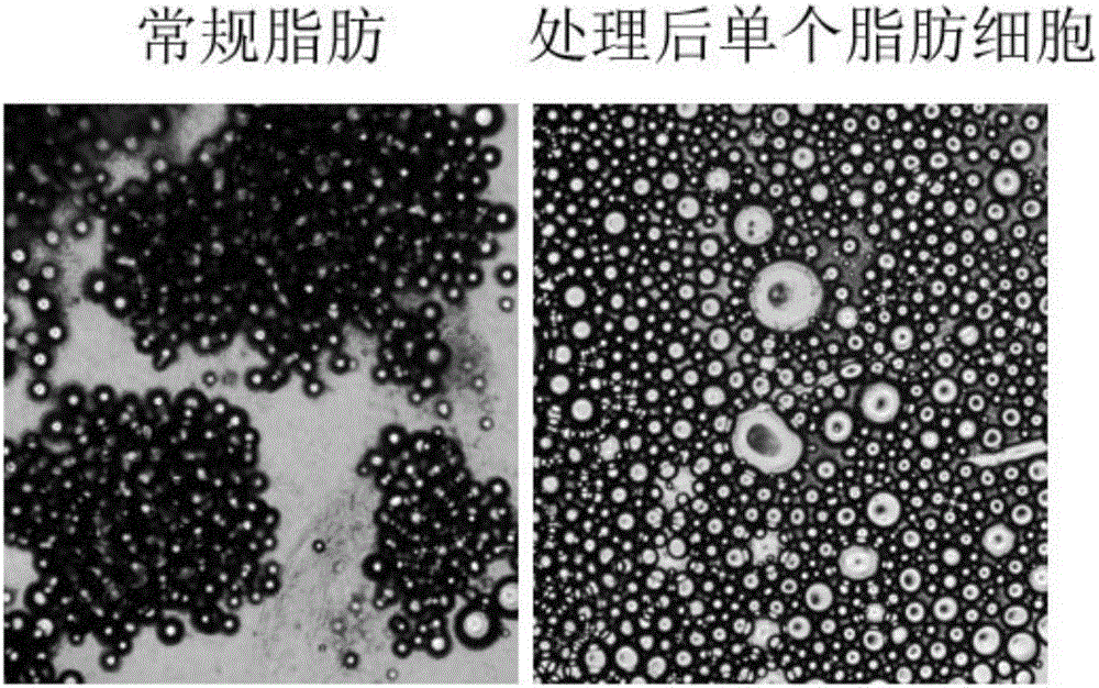 Processing method of adipose tissue, mesenchymal stem cell, single processed adipose cell, and extracellular matrix